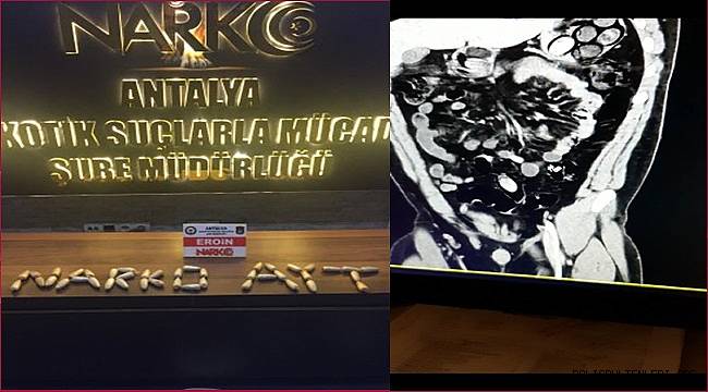 Antalya'da Uyuşturucu Maddeyi Yutarak Antalya Havalimanından Geçirmeye Çalışan Yabancı Uyruklu Şahıs Yakalandı