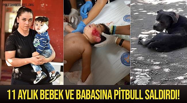 Antalya'da pitbull 11 aylık bebeğin yanağını ve kulağını kopardı