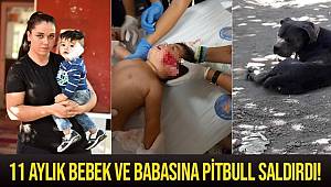 Antalya'da pitbull 11 aylık bebeğin yanağını ve kulağını kopardı