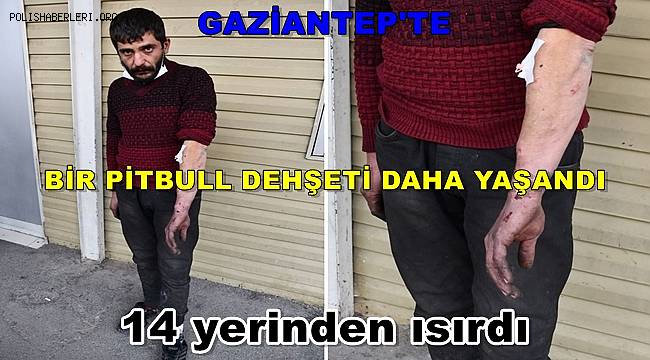 Gaziantep'te bir pitbull dehşeti daha yaşandı! 14 yerinden ısırdı 