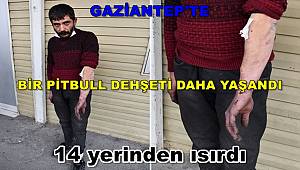 Gaziantep'te bir pitbull dehşeti daha yaşandı! 14 yerinden ısırdı 