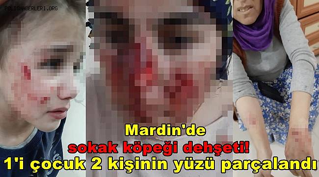 Mardin'de sokak köpeği vahşeti, Vatandaşların yüzleri parçalandı
