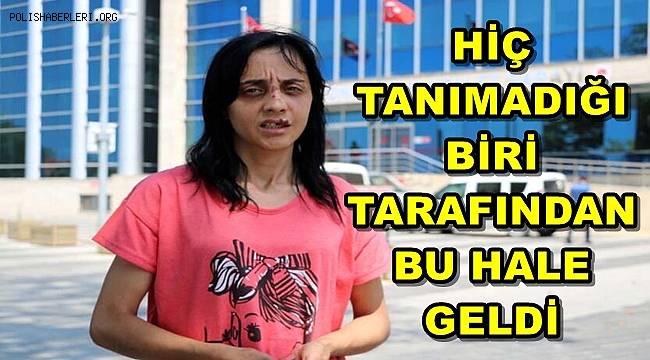 Sokakta Tanımadığı Kadına Yumruk Atıp, Dişlerini Kırdı