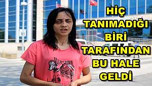 Sokakta Tanımadığı Kadına Yumruk Atıp, Dişlerini Kırdı