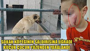 Bursa'da sokak köpeğinin saldırısına uğrayan çocuk yüzünden yaralandı