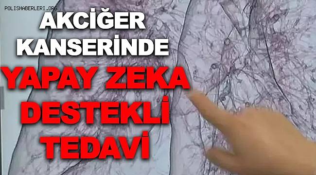 Akciğer kanserinde yapay zeka destekli tedavi 