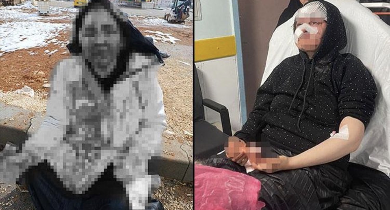 Boşanma aşamasındaki eşine kaldırım taşıyla saldırdı