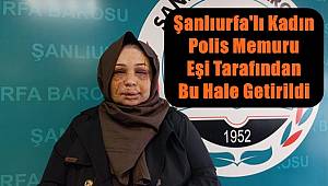 Şanlıurfalı Kadın Polis Memuru Eşi Tarafından Darp Edilip Bu Hale Geldi