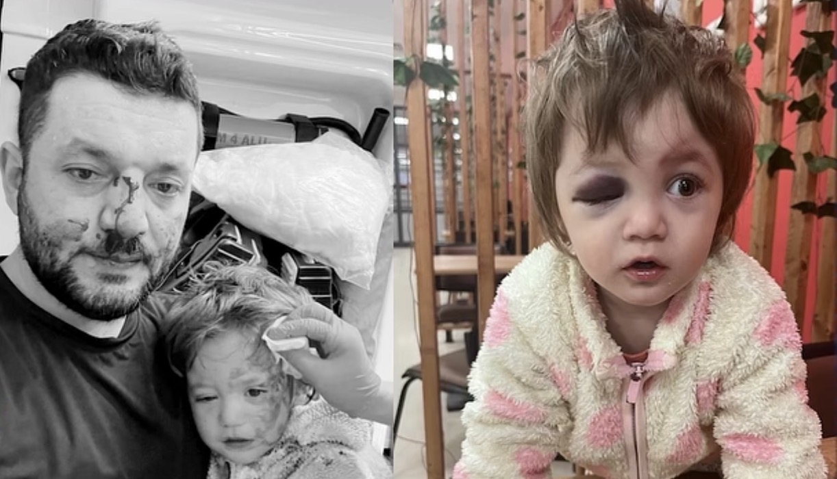 14 Aylık Bebeğe Aldırış Etmeden Darp Ettiler! Baba Muhammet Konuştu; “Evimize Gitmeye Korkuyoruz” 