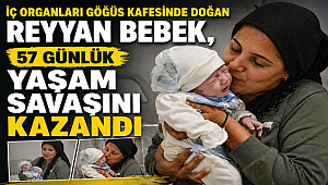 İç Organları Göğüs Kafesinde Doğan Reyyan Bebek, 57 Günlük Yaşam Savaşını Kazandı 