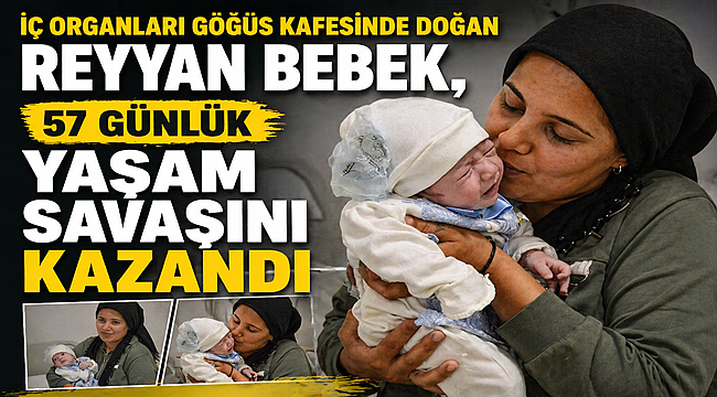 İç Organları Göğüs Kafesinde Doğan Reyyan Bebek, 57 Günlük Yaşam Savaşını Kazandı 