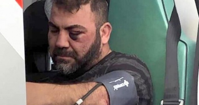 Alman polisi, Türk vatandaşını darp ettikten sonra sokağa bıraktı! - Haber