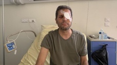 Fransız polisi tarafından gözünden yaralanan AA Foto Muhabiri Yalçın yaşadıklarını anlattı