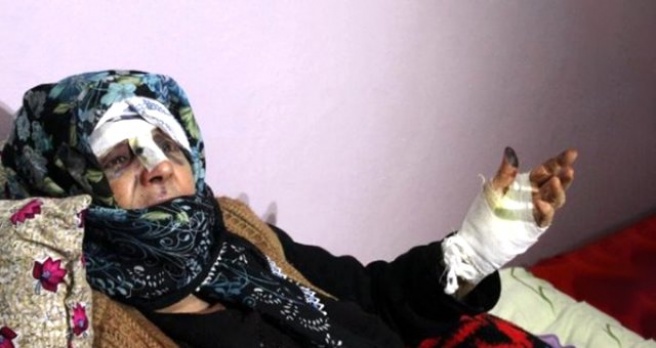Yaşlı Kadının Parmağını Kırıp Yüzüğünü Çalan Cani Komşunun Cezası Belli Oldu!